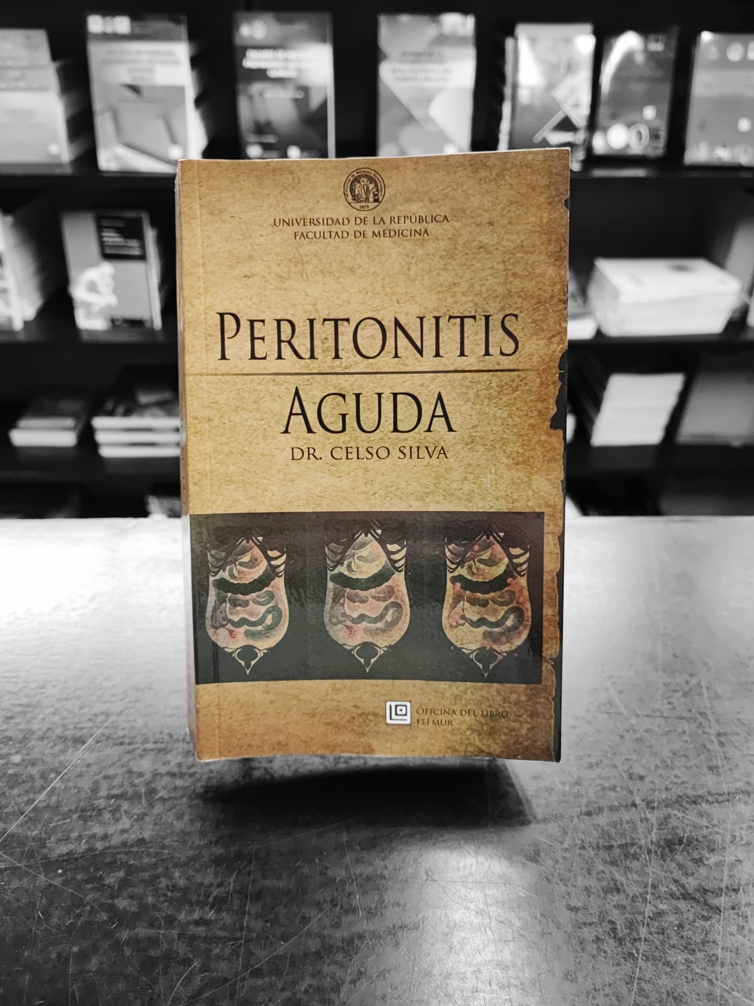 Peritonitis Aguda. Dr. Celso Silva. Fefmur